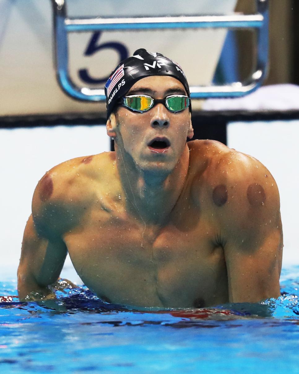 Phelps cupping.jpg