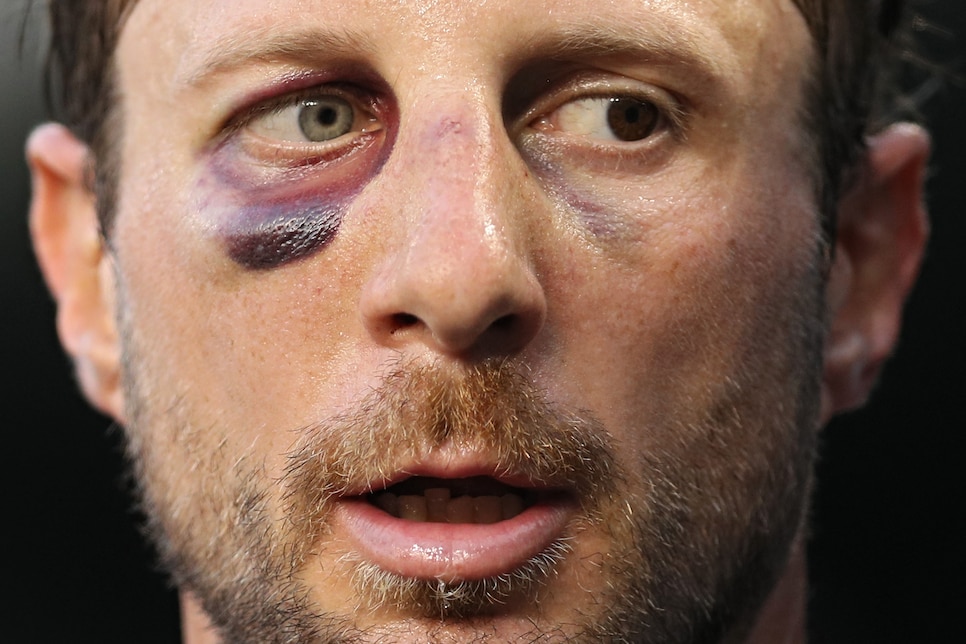 Nationals' Max Scherzer learns to like his different eye colors