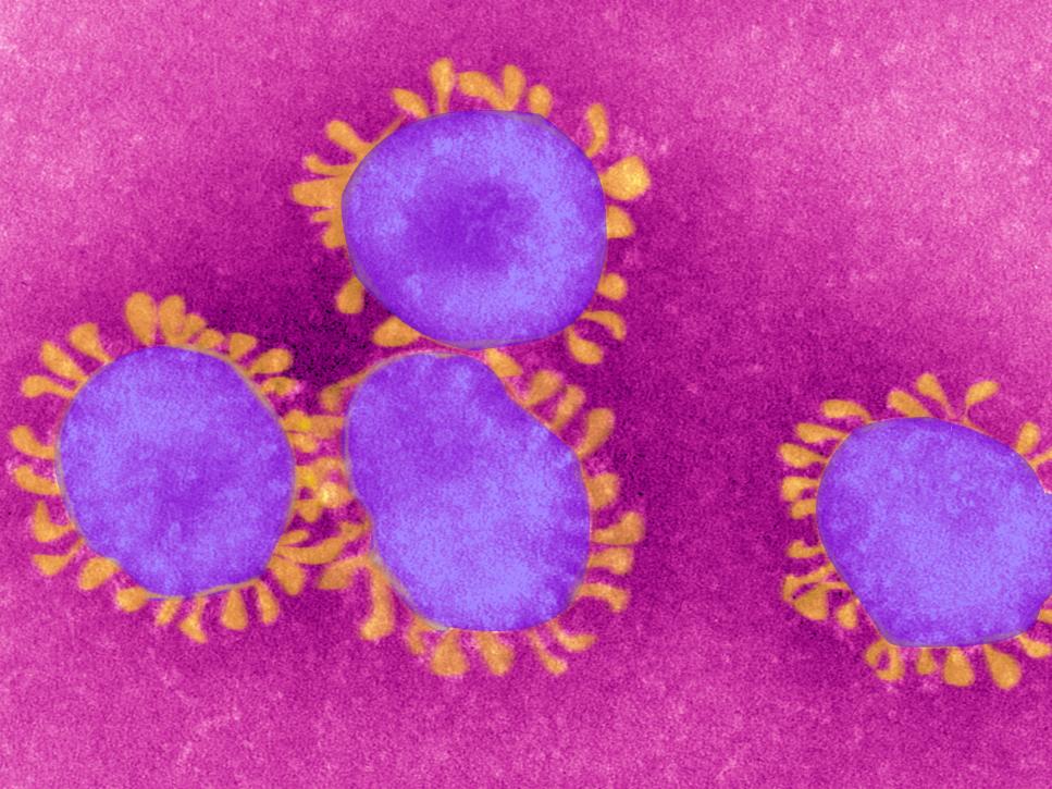 Colorized Tem. The Coronaviruses Owe Their Name To The The Crown Like Projections, Visible Under Microscope, That Encircle The Capsid. The Coronaviruses Are Responsible For Respiratory Ailments And Gastro Enteritis. The Virus Responsible For Sars Belongs To This Family. (Photo By BSIP/UIG Via Getty Images)