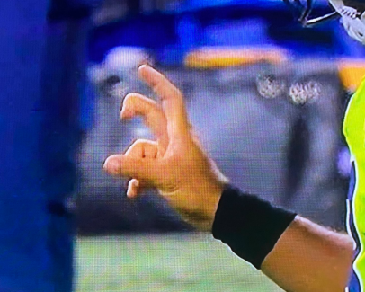 Hopefully you didn't eat anything before seeing these closeups Russell Wilson's finger | This is the Golf Digest