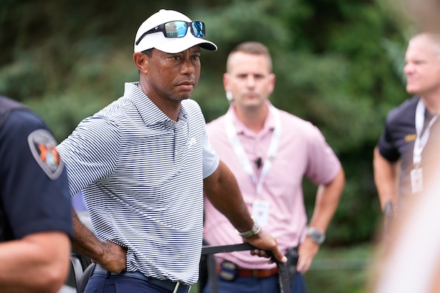 Seeing Tiger Woods’ car crash scars for first time will make you appreciate his legendary grit even more