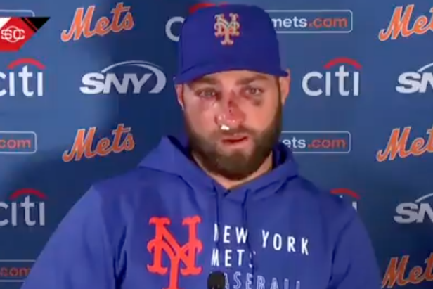Mets update Kevin Pillar's status after taking fastball to the face Monday  vs. Braves 