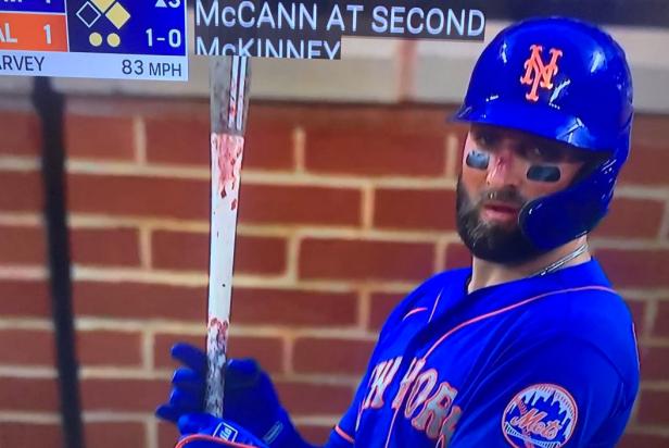 Watch: Kevin Pillar gets hit in first at-bat since being nailed in face