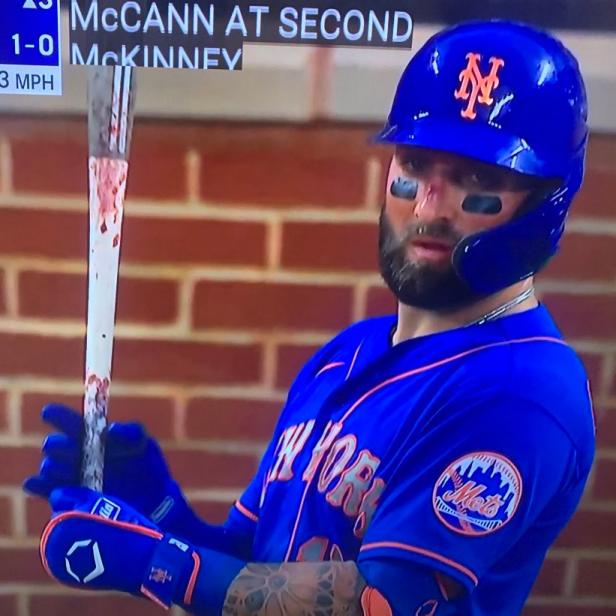 What happened to New York Mets' Kevin Pillar's face?