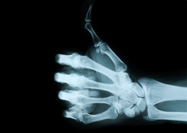 protect-your-wrists-this-golf-season