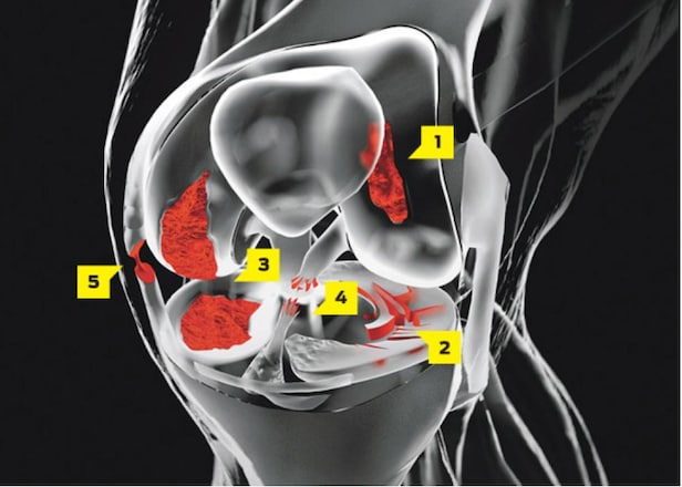 these-are-the-most-common-golf-knee-injuries-—-and-how-to-treat-them