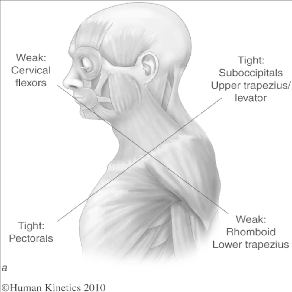 /content/dam/images/golfdigest/fullset/fitness-2023/upper crossed syndrome.png